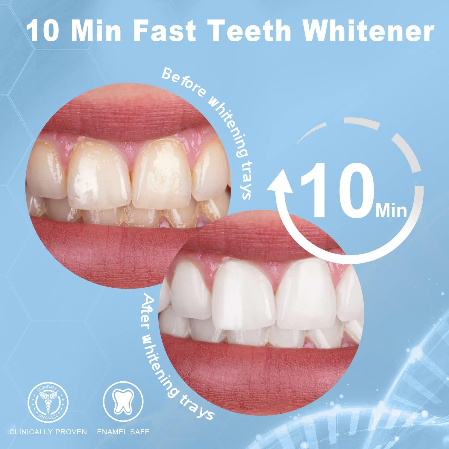 image:imageMySmile 1Pcs 28LED Teeth Whitening LED Light 3 Pcs Teeth Whitening Gel 2Pcs Tooth Whitening Pen 10 Min NonSensitive Fast Teeth Whitener Restores Your Gleaming White Smile