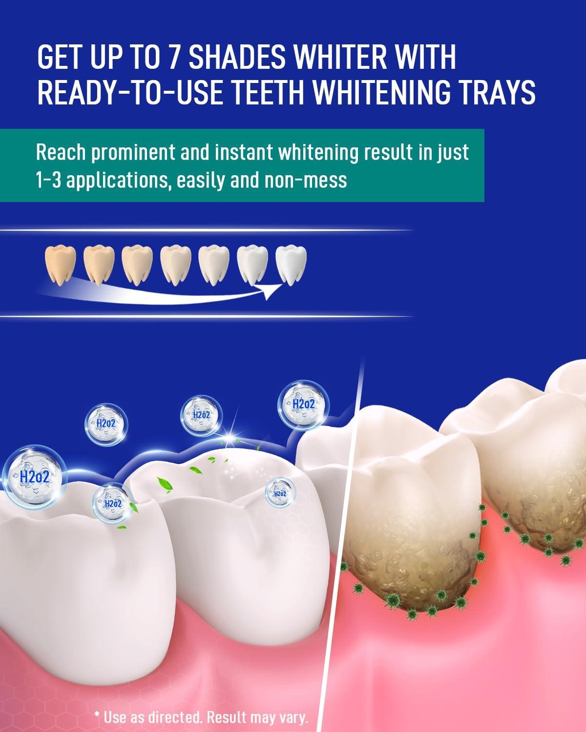image:imageMySmile 7 Treatments Prefilled Teeth Whitening Trays Kit with 12 Hydrogen Peroxide Whiter Gel for Sensitive Tooth FastResult Vegan Teeth Whitener UWraps Tooth Stain Remover Mint Flavor2 Count Pack of 8