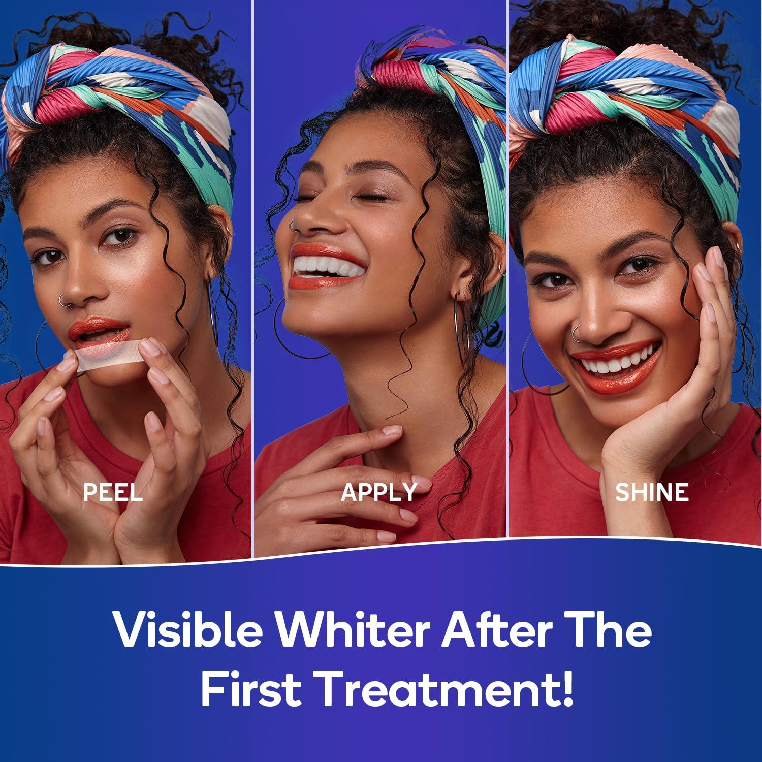 image:imageMySmile Advanced Teeth Whitening Strips NonSensitive Formulated 5X Plus Whitening Results Safe for Enamel 10 Whitening Strips Dental Stain Remover for Whiter Smile Removes Years of Stains