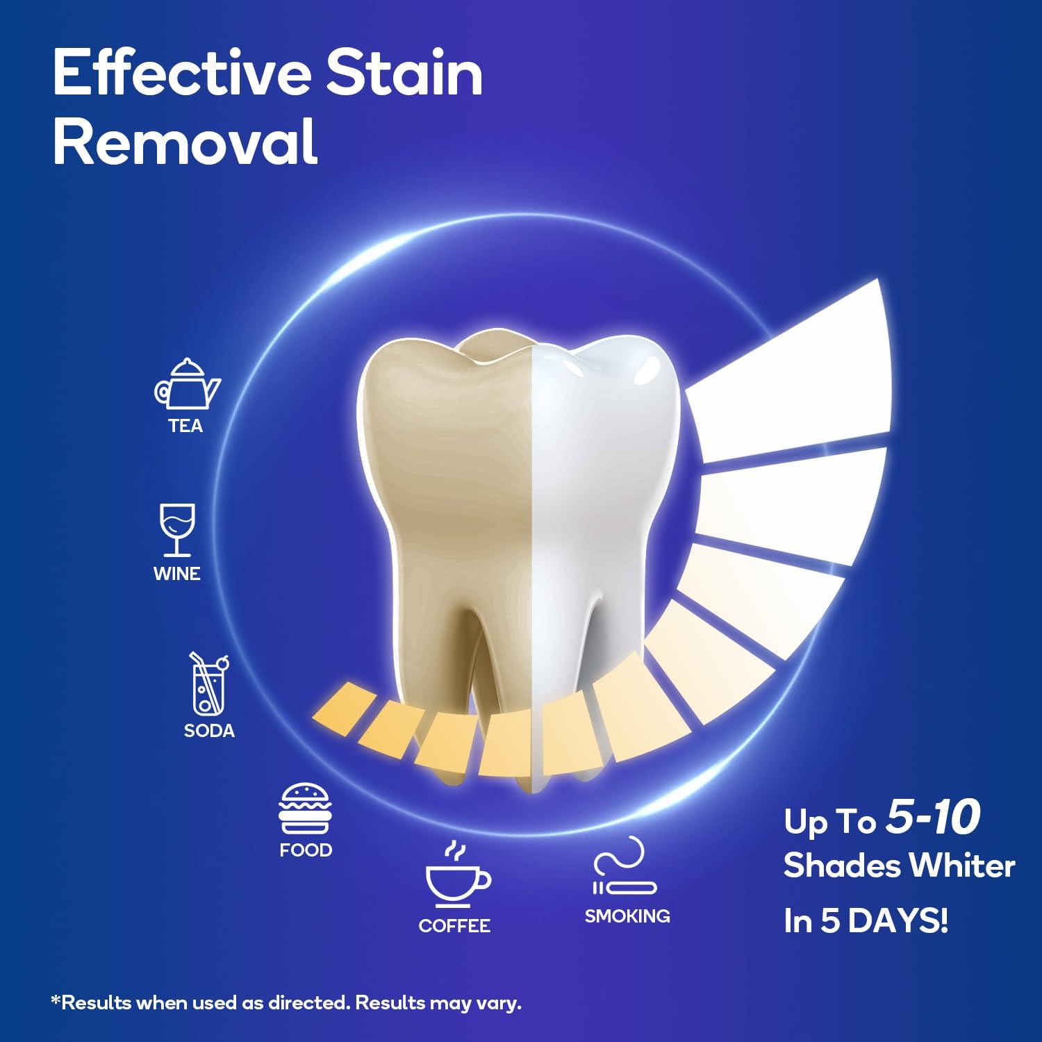 image:imageMySmile Advanced Teeth Whitening Strips NonSensitive Formulated 5X Plus Whitening Results Safe for Enamel 10 Whitening Strips Dental Stain Remover for Whiter Smile Removes Years of Stains