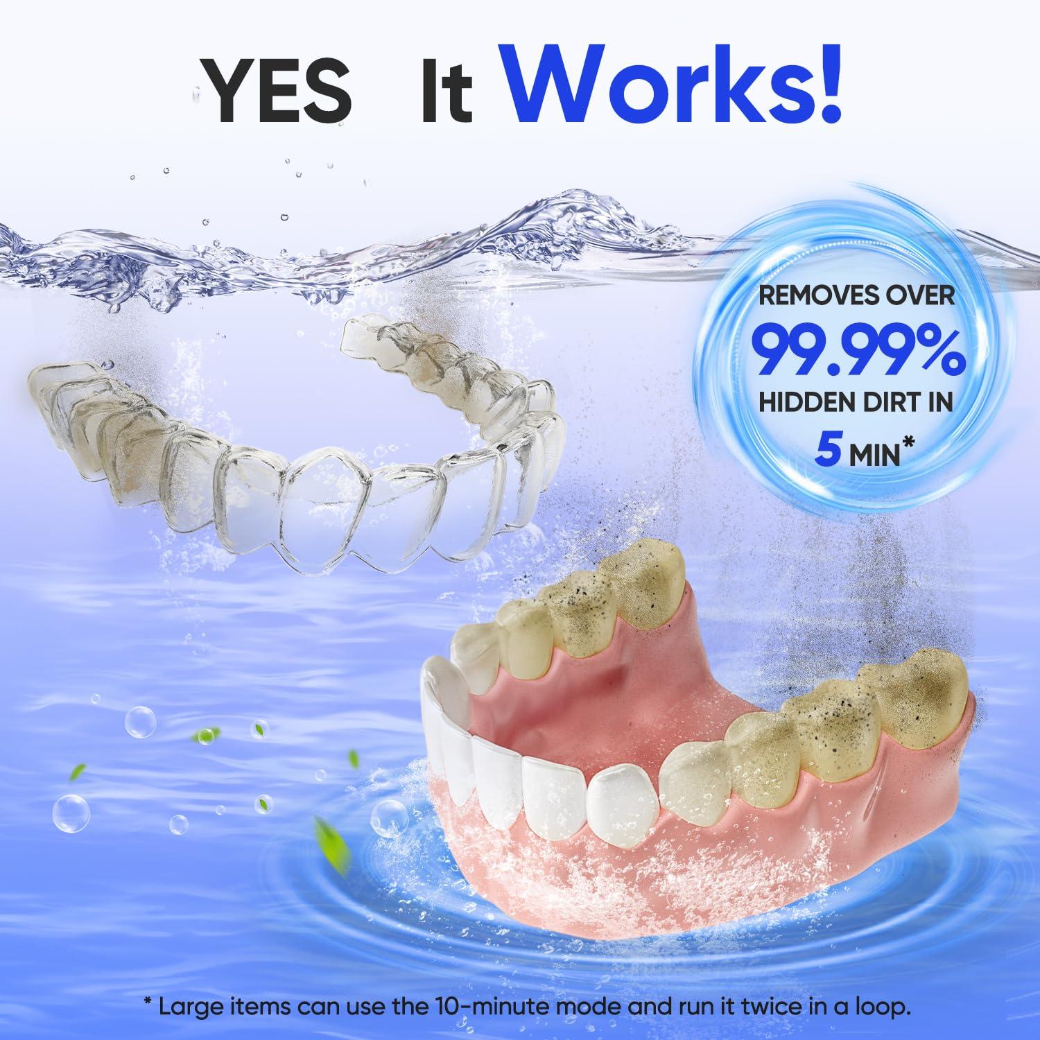 image:imageMySmile Dental Ultrasonic Retainer Cleaner Machine 45kHz UV Denture Cleaner with 200ML Capacity for Aligner Braces Mouth Guard Night Guard Portable Dental Cleaning Pod with Digital Timer BlackBlack