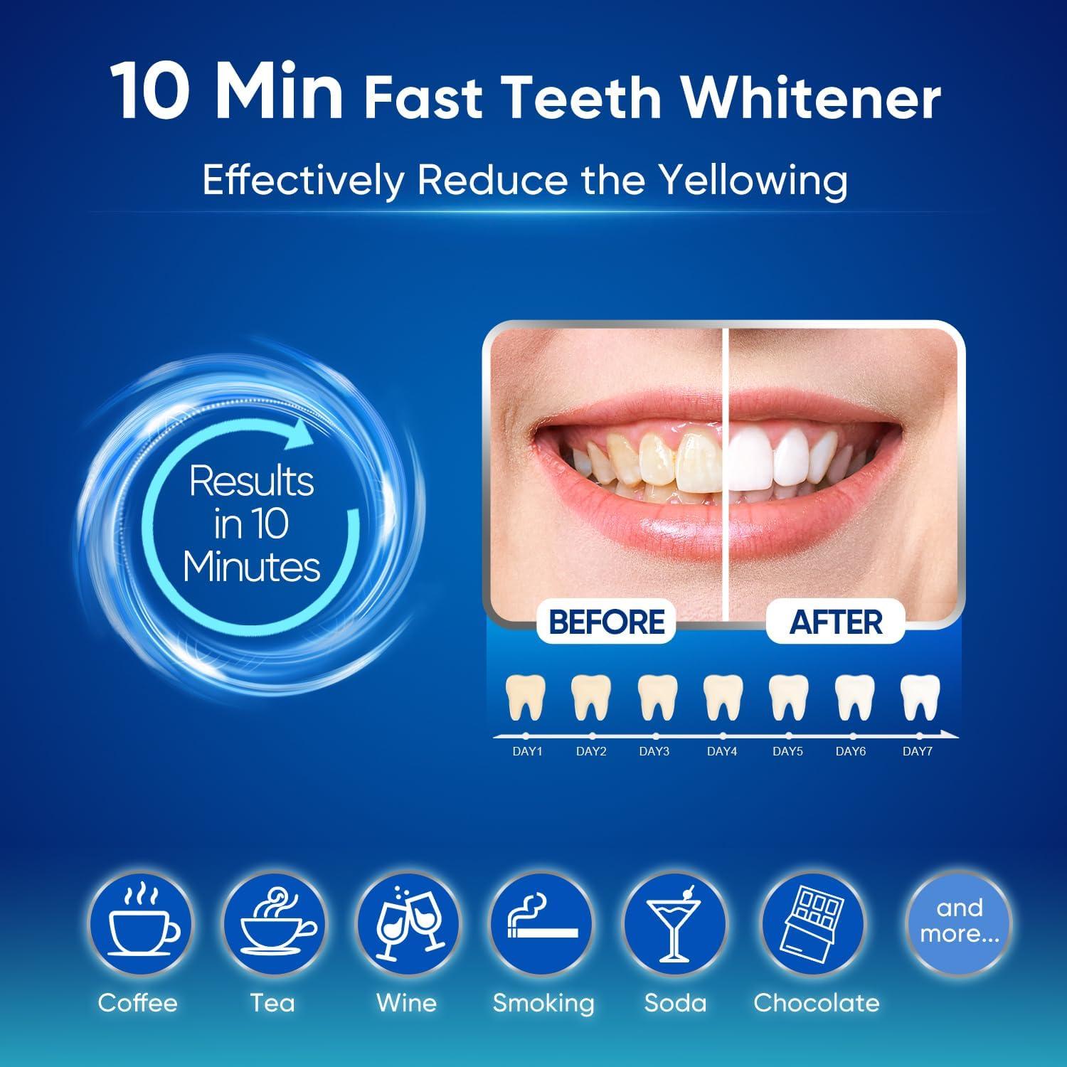image:imageMySmile Teeth Whitening Kit for Sensitive Teeth with LED Light 10 Min NonSensitive Fast Tooth Whitener 3 Carbamide Peroxide Whitening Gel Powerful Formula Enamel SafeBlue