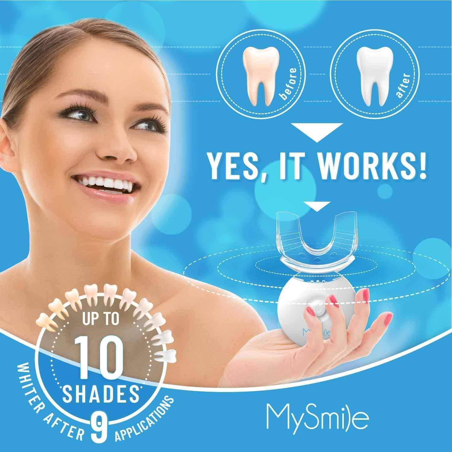 image:imageMySmile Teeth Whitening Kit with LED Light 10 Min NonSensitive Fast Teeth Whitener with 3 Carbamide Peroxide Whitening Gel Helps to Remove Stains from Coffee Smoking Wines Soda Food
