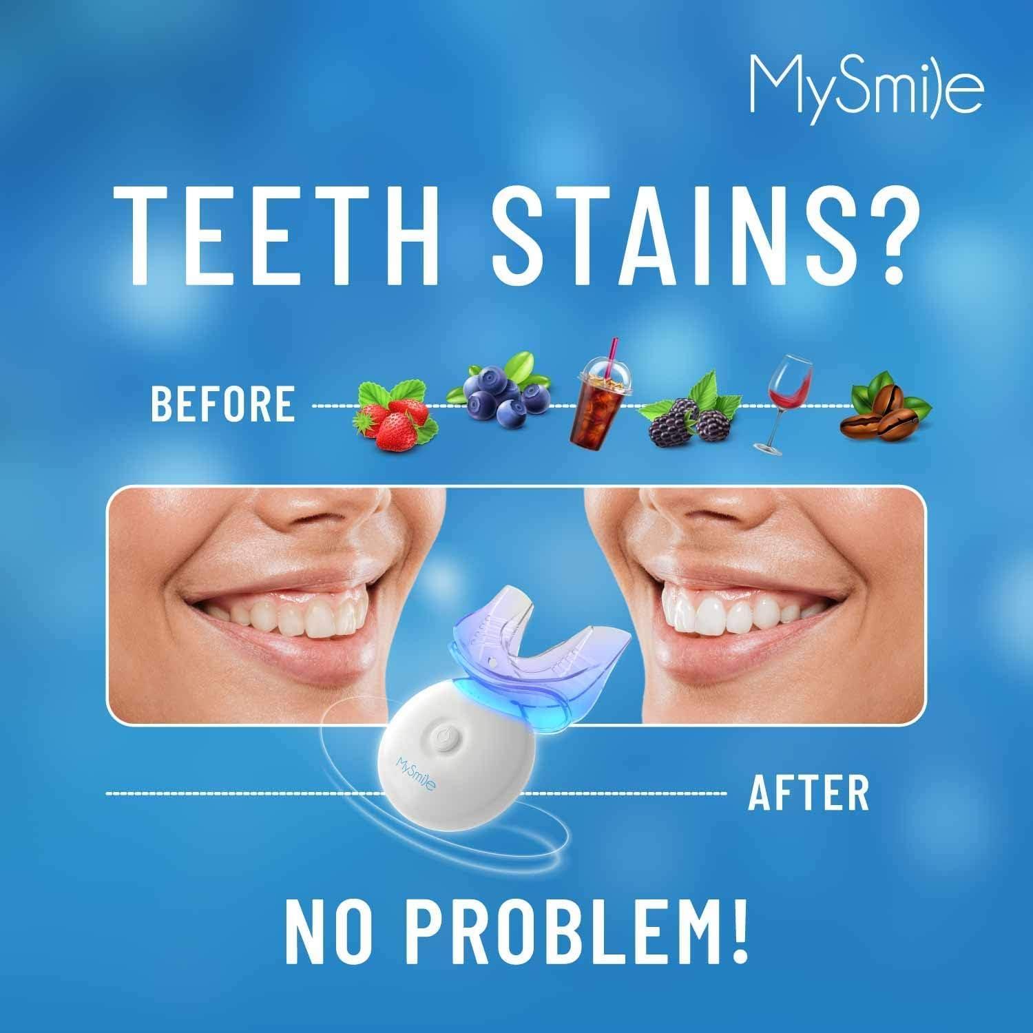 image:imageMySmile Teeth Whitening Kit with LED Light 10 Min NonSensitive Fast Teeth Whitener with 3 Carbamide Peroxide Whitening Gel Helps to Remove Stains from Coffee Smoking Wines Soda Food