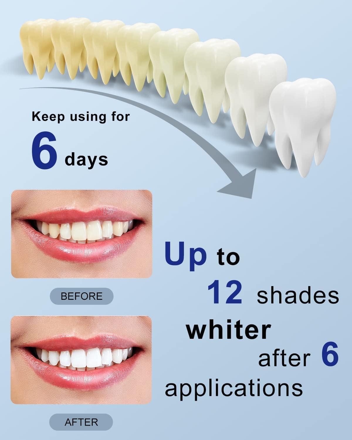 image:imageMySmile Teeth Whitening Pen 30 Treatment Enamel Safe Tooth Whitening Gel for Teeth Sensitive10 Min Fast Whitening TeethHelps to Remove Stains from Coffee Smoking WinesMint Flavor28 Fl Oz Pack of 1