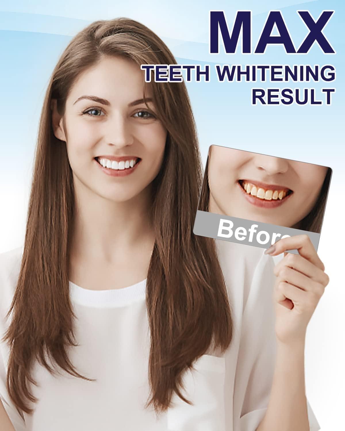 image:imageMySmile Teeth Whitening Pen 30 Treatment Enamel Safe Tooth Whitening Gel for Teeth Sensitive10 Min Fast Whitening TeethHelps to Remove Stains from Coffee Smoking WinesMint Flavor027 Fl Oz Pack of 1