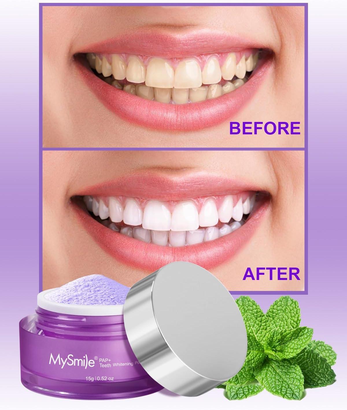 image:imageMySmile Teeth Whitening Powder for Tooth Whitening Toothpaste Natural Powder Teeth Whitener Enamel Safe Whitening Tooth Cleaning Powder Tooth Stain Remover and Polisher Fresh MintBright Purple