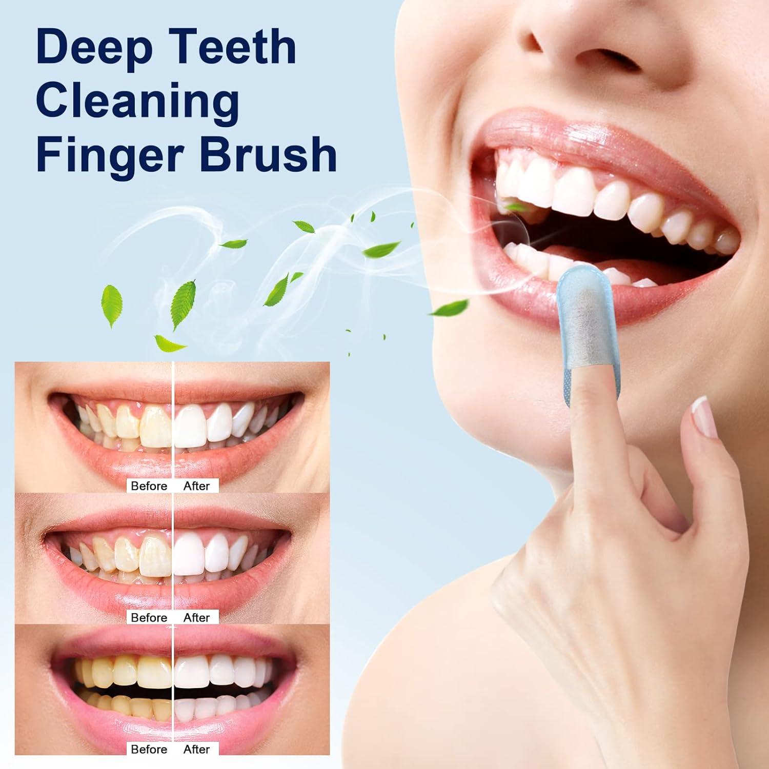 image:imageMySmile Teeth Wipes 100pcs Disposal Finger Brush Deep Cleaning Wipes Oral Brush Ups Tooth Wipes For Teeth Cleaning Oral Freshes Mint FlavorBlue
