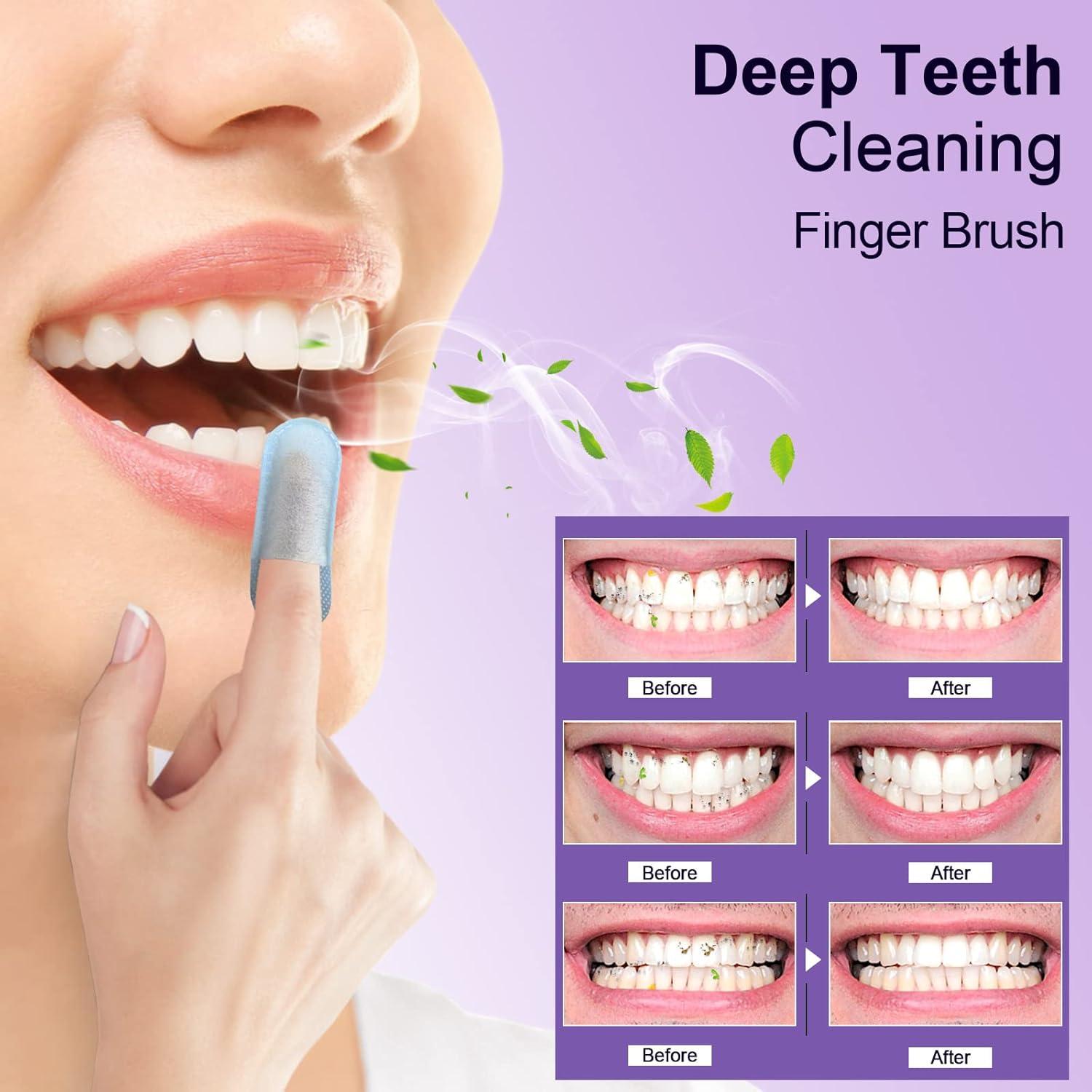 image:imageMySmile Teeth Wipes 100pcs Disposal Finger Brush Deep Cleaning Wipes Oral Brush Ups Tooth Wipes For Teeth Cleaning Oral Freshes Mint FlavorPurple
